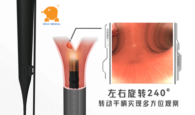 為什么要使用電子支氣管鏡？廠家告訴您 (1).gif