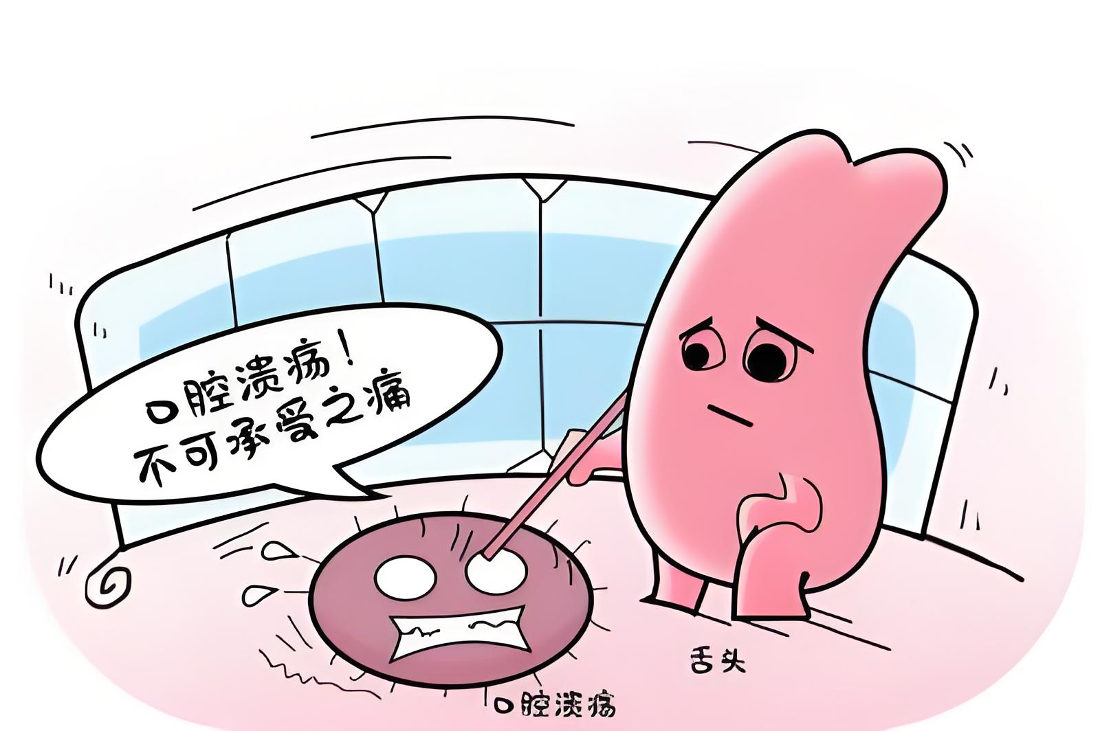 口腔溃疡4.jpg