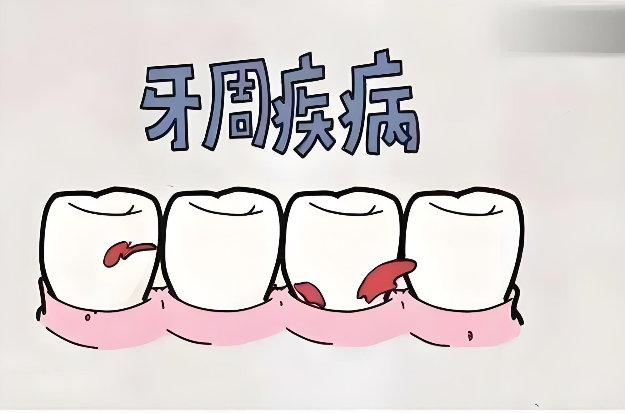 牙周病.jpg