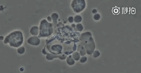 640_wx_fmt=gif&wxfrom=5&wx_lazy=1&tp=webp (3).gif